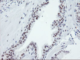 SENP2 Antibody in Immunohistochemistry (Paraffin) (IHC (P))