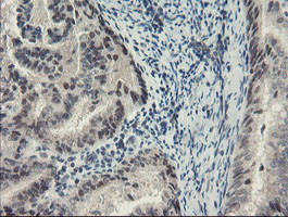 SENP2 Antibody in Immunohistochemistry (Paraffin) (IHC (P))