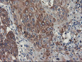 SENP2 Antibody in Immunohistochemistry (Paraffin) (IHC (P))