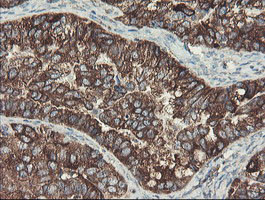 SENP2 Antibody in Immunohistochemistry (Paraffin) (IHC (P))