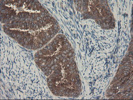 SENP2 Antibody in Immunohistochemistry (Paraffin) (IHC (P))