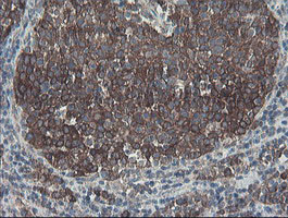 SENP2 Antibody in Immunohistochemistry (Paraffin) (IHC (P))