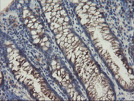 SENP2 Antibody in Immunohistochemistry (Paraffin) (IHC (P))