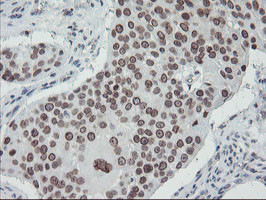 SENP2 Antibody in Immunohistochemistry (Paraffin) (IHC (P))