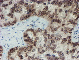 SENP2 Antibody in Immunohistochemistry (Paraffin) (IHC (P))