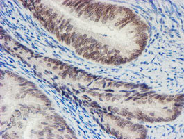 SENP2 Antibody in Immunohistochemistry (Paraffin) (IHC (P))