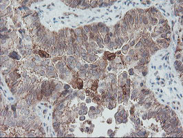 SENP2 Antibody in Immunohistochemistry (Paraffin) (IHC (P))