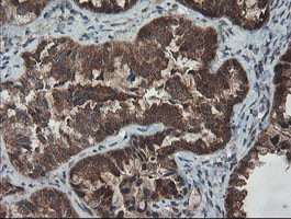 SENP2 Antibody in Immunohistochemistry (Paraffin) (IHC (P))