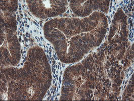 SENP2 Antibody in Immunohistochemistry (Paraffin) (IHC (P))