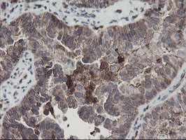 SENP2 Antibody in Immunohistochemistry (Paraffin) (IHC (P))