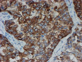 SENP2 Antibody in Immunohistochemistry (Paraffin) (IHC (P))