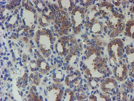 SENP2 Antibody in Immunohistochemistry (Paraffin) (IHC (P))