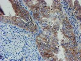 SENP2 Antibody in Immunohistochemistry (Paraffin) (IHC (P))