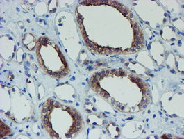 SENP2 Antibody in Immunohistochemistry (Paraffin) (IHC (P))