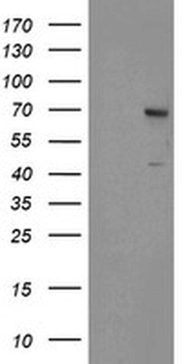 SENP2 Antibody in Western Blot (WB)