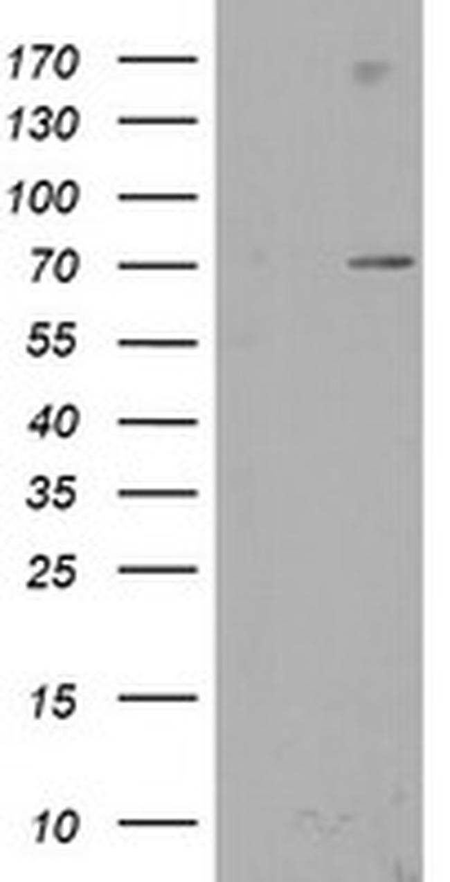 SENP2 Antibody in Western Blot (WB)