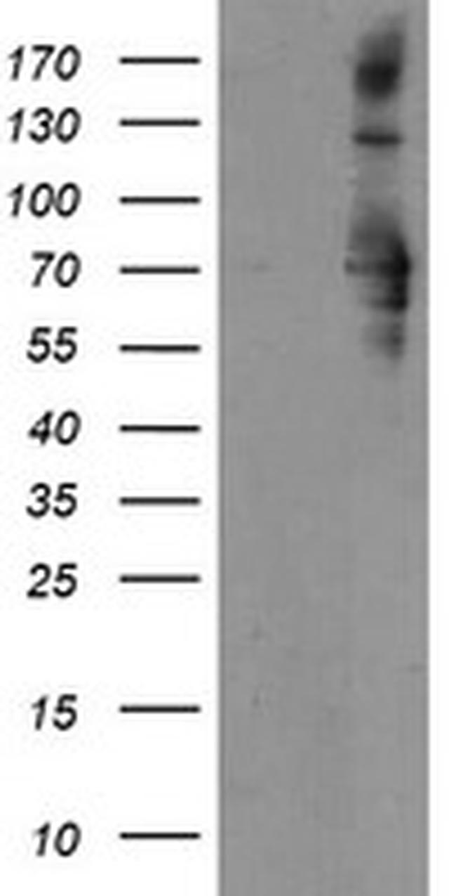 SENP2 Antibody in Western Blot (WB)