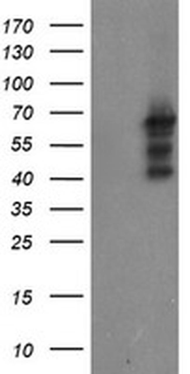 SENP2 Antibody in Western Blot (WB)