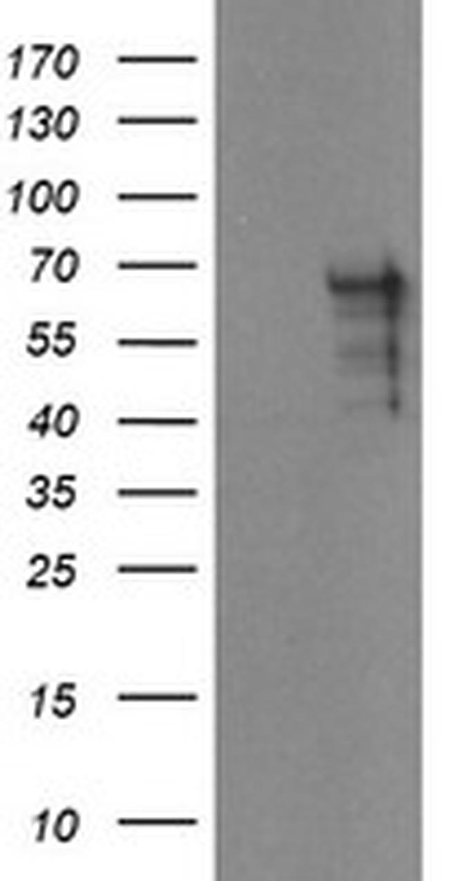 SENP2 Antibody in Western Blot (WB)