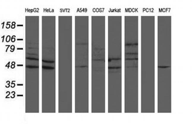 SENP2 Antibody in Western Blot (WB)