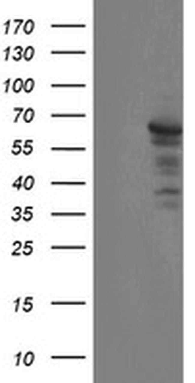 SENP2 Antibody in Western Blot (WB)