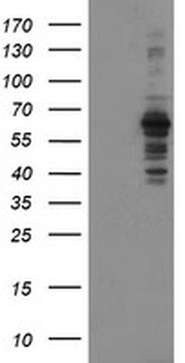 SENP2 Antibody in Western Blot (WB)