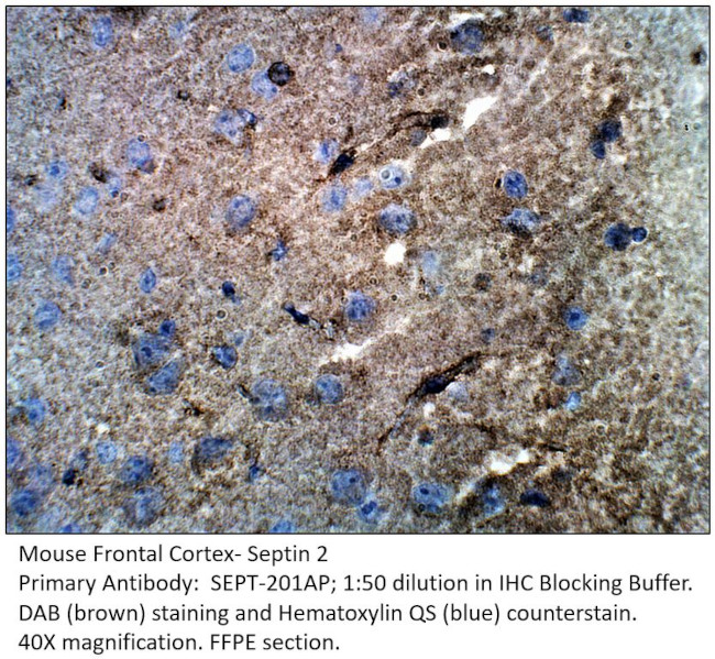 Septin 2 Antibody in Immunohistochemistry (IHC)