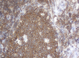 SERBP1 Antibody in Immunohistochemistry (Paraffin) (IHC (P))