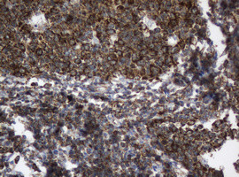 SERBP1 Antibody in Immunohistochemistry (Paraffin) (IHC (P))