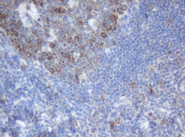 SERBP1 Antibody in Immunohistochemistry (Paraffin) (IHC (P))