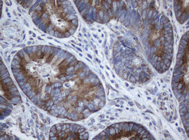 SERBP1 Antibody in Immunohistochemistry (Paraffin) (IHC (P))