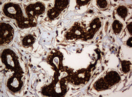 SERBP1 Antibody in Immunohistochemistry (Paraffin) (IHC (P))