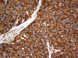 SERBP1 Antibody in Immunohistochemistry (Paraffin) (IHC (P))