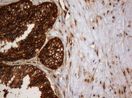 SERBP1 Antibody in Immunohistochemistry (Paraffin) (IHC (P))