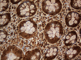 SERBP1 Antibody in Immunohistochemistry (Paraffin) (IHC (P))