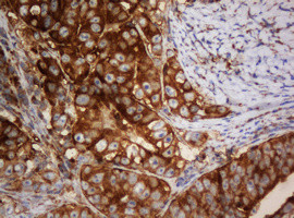 SERBP1 Antibody in Immunohistochemistry (Paraffin) (IHC (P))