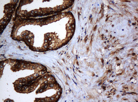 SERBP1 Antibody in Immunohistochemistry (Paraffin) (IHC (P))