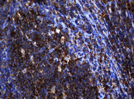 SERBP1 Antibody in Immunohistochemistry (Paraffin) (IHC (P))