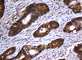 SERBP1 Antibody in Immunohistochemistry (Paraffin) (IHC (P))