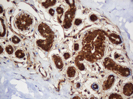 SERBP1 Antibody in Immunohistochemistry (Paraffin) (IHC (P))