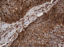 SERBP1 Antibody in Immunohistochemistry (Paraffin) (IHC (P))