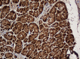 SERBP1 Antibody in Immunohistochemistry (Paraffin) (IHC (P))