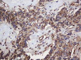 SERBP1 Antibody in Immunohistochemistry (Paraffin) (IHC (P))