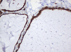 SERBP1 Antibody in Immunohistochemistry (Paraffin) (IHC (P))