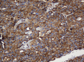 SERBP1 Antibody in Immunohistochemistry (Paraffin) (IHC (P))