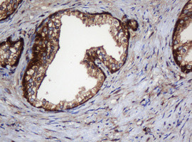 SERBP1 Antibody in Immunohistochemistry (Paraffin) (IHC (P))