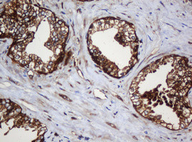 SERBP1 Antibody in Immunohistochemistry (Paraffin) (IHC (P))