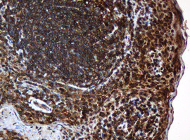 SERBP1 Antibody in Immunohistochemistry (Paraffin) (IHC (P))