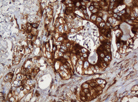 SERBP1 Antibody in Immunohistochemistry (Paraffin) (IHC (P))