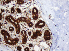 SERBP1 Antibody in Immunohistochemistry (Paraffin) (IHC (P))